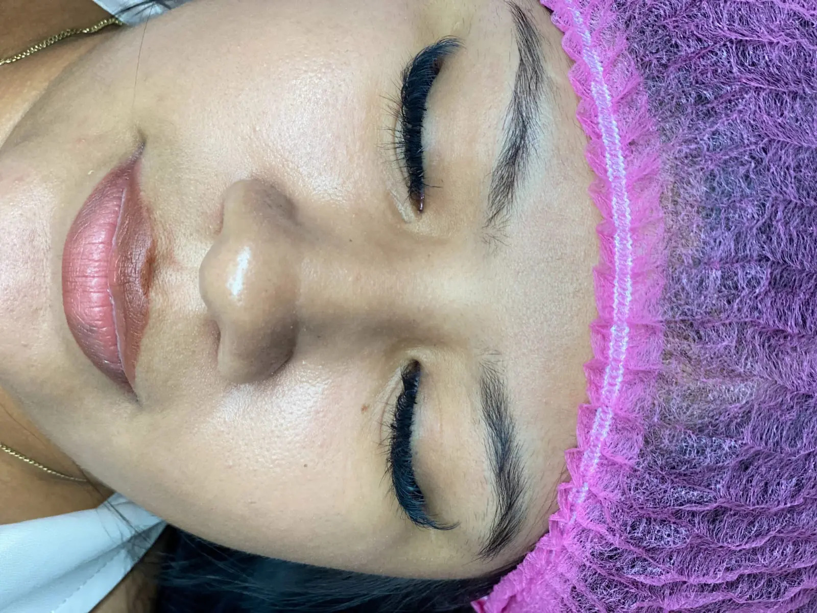 Cejas antes de micropigmentación en Managua — escasas y sin definición